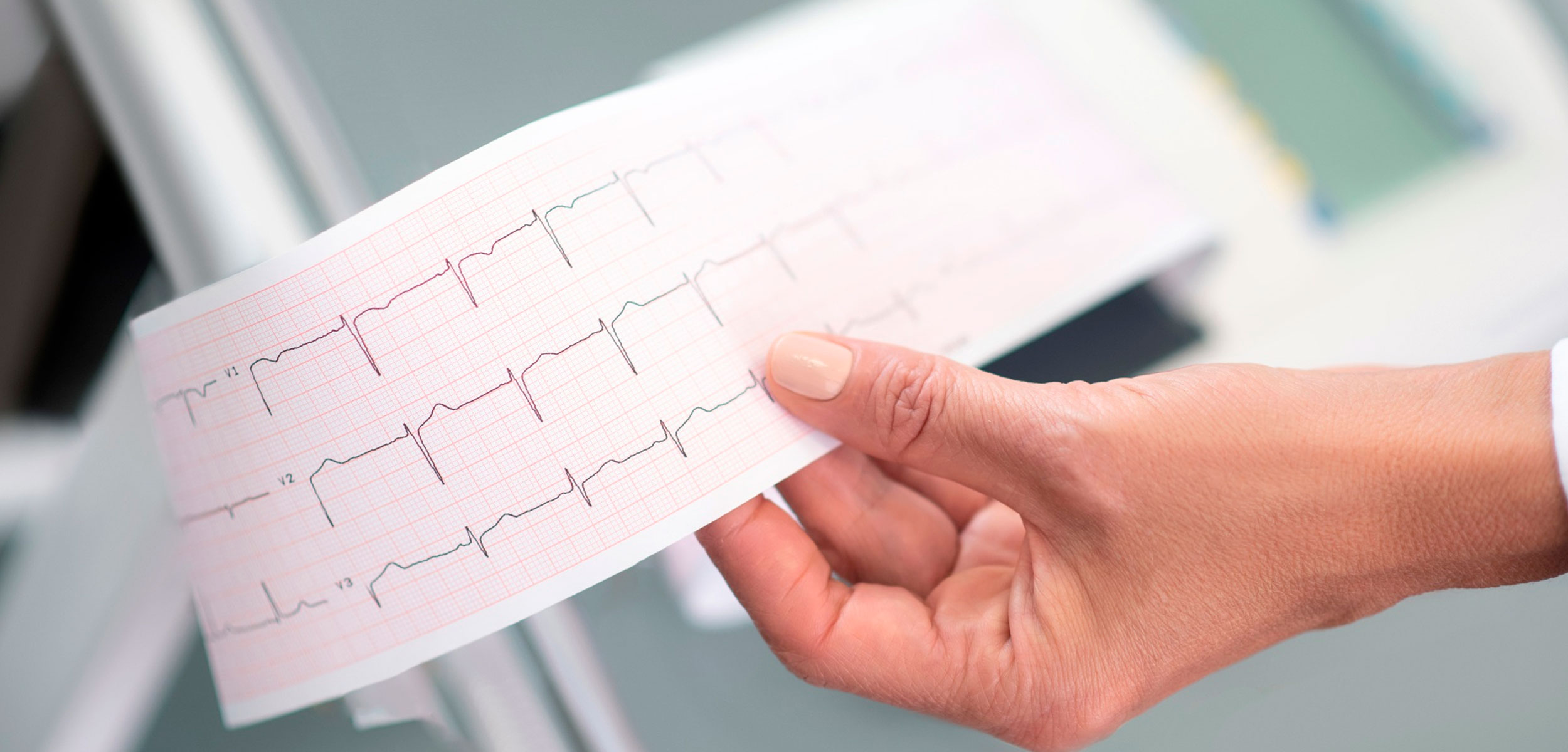electrocardiograma rancagua