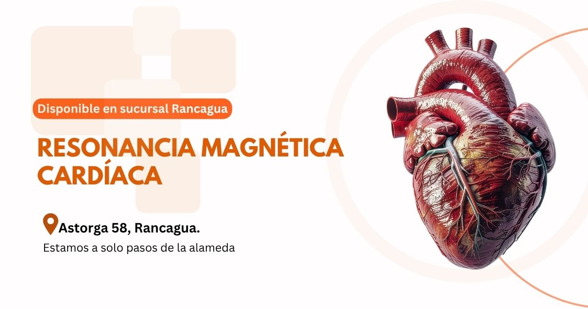 Resonancia magnética cardíaca en Centro de Diagnóstico San Lorenzo, Rancagua