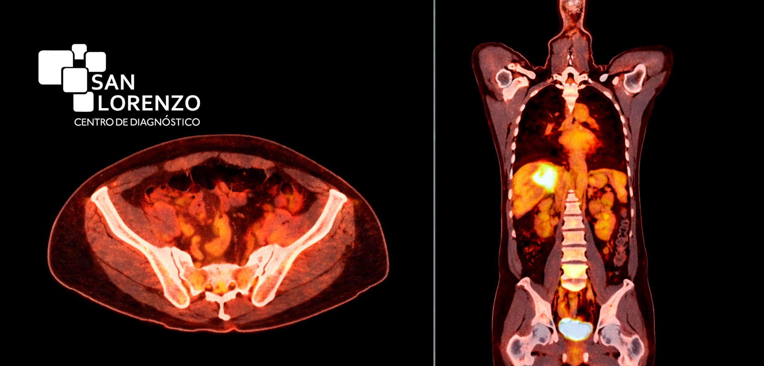 Tecnología médica avanzada para diagnóstico oncológico en Región de O'Higgins